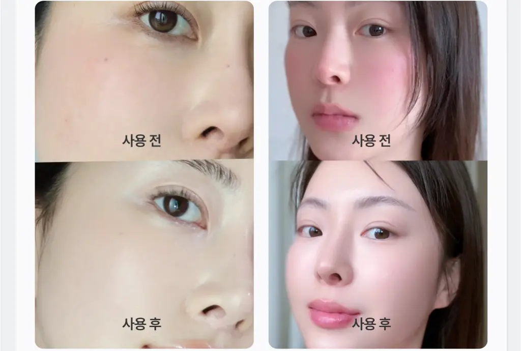 [PDRN/EGF 진정케어]가쉬 10초 마이크로 버블팩 트리플 슈퍼 리페어 150회분 상세페이지 19